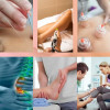 Physio Treatment Clinic